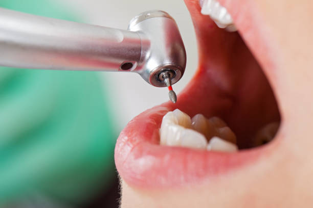 Best Dentist for Tooth Abscess  in Columbia, TN